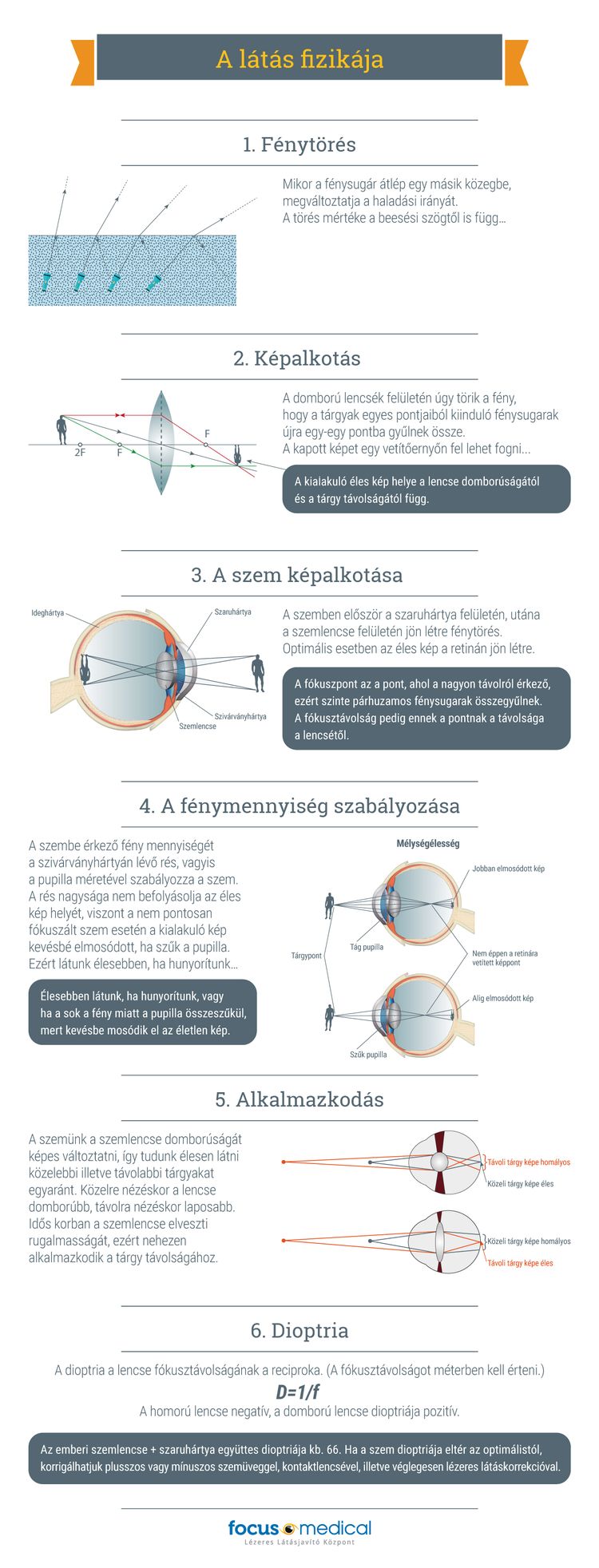 rövidlátás mínusz 10 hogyan lehet helyreállítani a látásképzést