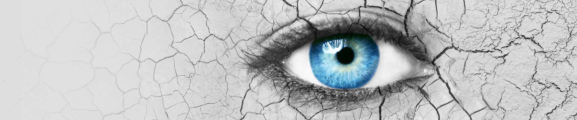 Rexon-Eye száraz szem kezelés